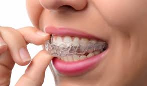 teeth-straightening-treatment-1